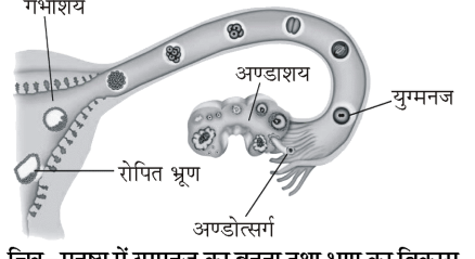 कक्षा 8 विज्ञान पाठ 6 चित्र 10